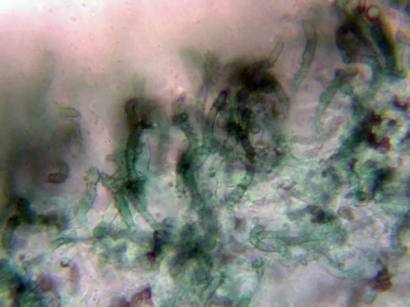 Chlorociboria aeruginosa 12 - Pelos marginales agua-002